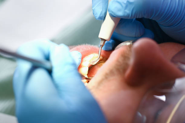 Emergency Gum Pain Relief in MD