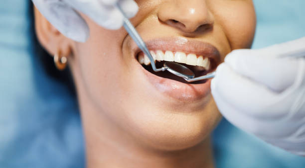 Best Dentist for Tooth Abscess  in Potomac Heights, MD