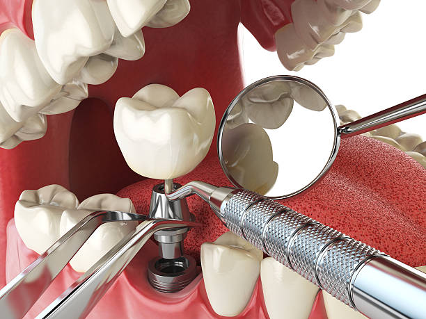 Best Emergency Dental Filling Replacement  in Potomac Heights, MD